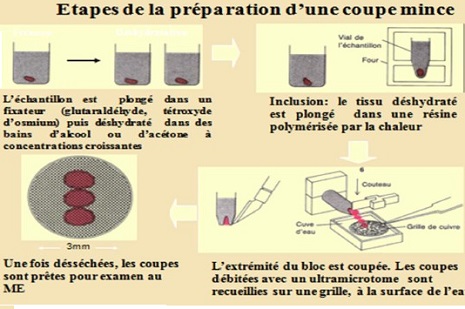 microscopie électronique