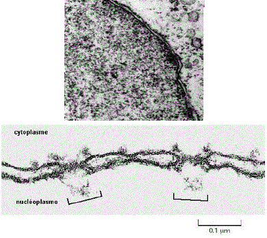 nucleus microscopie électronique