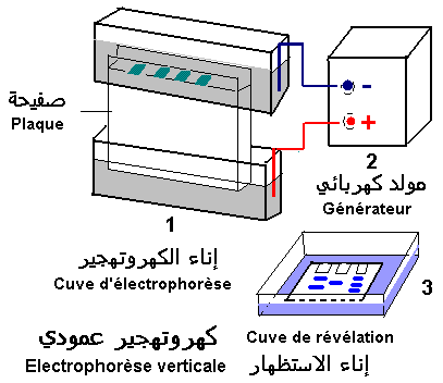 composantes de la séparation électrophorétique